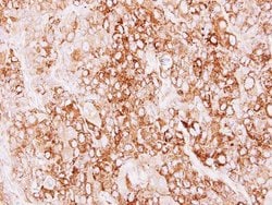 Invitrogen Creatine Kinase MT Polyclonal Antibody 100 &mu;L; Unconjugated:Antibodies,