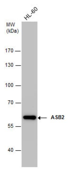 Invitrogen ASB2 Polyclonal Antibody 100 &mu;L; Unconjugated:Antibodies,