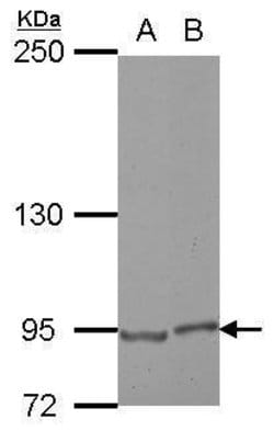 Invitrogen E2F8 Polyclonal Antibody 100 &mu;L; Unconjugated:Antibodies,