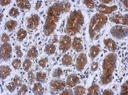 Invitrogen UPF1 Polyclonal Antibody 100 μL; Unconjugated:Antibodies,
