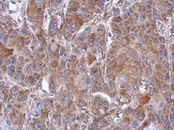 Invitrogen eIF3e Polyclonal Antibody 100 &mu;L; Unconjugated:Antibodies,
