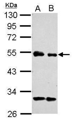 Invitrogen eIF3e Polyclonal Antibody 100 &mu;L; Unconjugated:Antibodies,