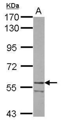 Invitrogen HMGCS1 Polyclonal Antibody 100 &mu;L | Buy Online | Invitrogen&trade; | Fisher Scientific