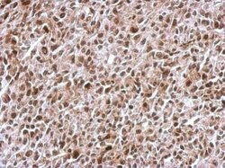 Invitrogen KID Polyclonal Antibody 100 &mu;L; Unconjugated:Antibodies,
