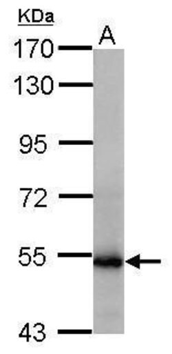 Invitrogen GluD1/GluD2 Polyclonal Antibody 100 &mu;L; Unconjugated:Antikörper