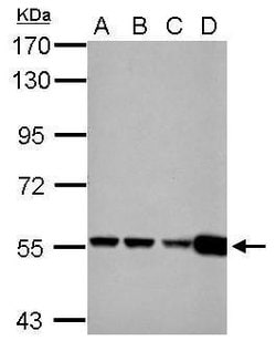 Invitrogen GluD1/GluD2 Polyclonal Antibody 100 &mu;L; Unconjugated:Antikörper
