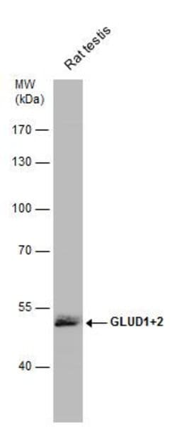 Invitrogen GluD1/GluD2 Polyclonal Antibody 100 &mu;L; Unconjugated:Antikörper