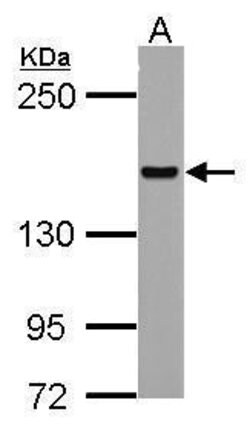 Invitrogen HDLBP Polyclonal Antibody 100 &mu;L; Unconjugated:Antibodies,