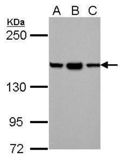Invitrogen HDLBP Polyclonal Antibody 100 &mu;L; Unconjugated:Antibodies,