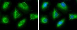 Invitrogen ATP Citrate Lyase Polyclonal Antibody 100 &mu;L; Unconjugated:Antibodies,