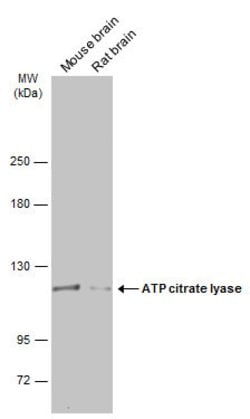 Invitrogen ATP Citrate Lyase Polyclonal Antibody 100 &mu;L; Unconjugated:Antibodies,