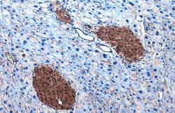 Invitrogen ATP Citrate Lyase Polyclonal Antibody 100 &mu;L; Unconjugated:Antibodies,