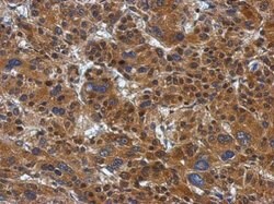 Invitrogen ATP Citrate Lyase Polyclonal Antibody 100 &mu;L; Unconjugated:Antibodies,