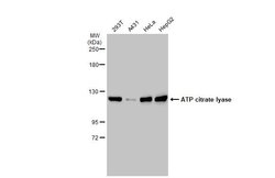 Invitrogen ATP Citrate Lyase Polyclonal Antibody 100 &mu;L; Unconjugated:Antibodies,