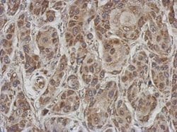 Invitrogen Afamin Polyclonal Antibody 100 &mu;L; Unconjugated:Antibodies,