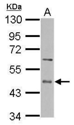 Invitrogen ENTPD5 Polyclonal Antibody 100 &mu;L; Unconjugated:Antibodies,
