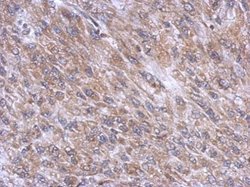 Invitrogen DYNC1I1 Polyclonal Antibody 100 &mu;L; Unconjugated:Antibodies,