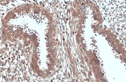 Invitrogen ACSL3 Polyclonal Antibody 100 &mu;L; Unconjugated:Antibodies,