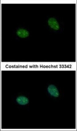 Invitrogen PRICKLE3 Polyclonal Antibody 100 μL; Unconjugated:Antibodies,