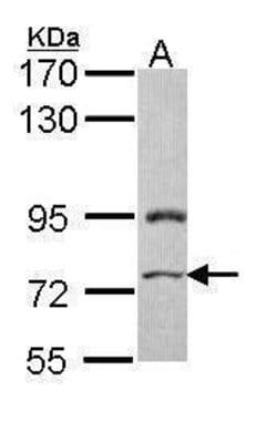 Invitrogen PRICKLE3 Polyclonal Antibody 100 μL; Unconjugated:Antibodies,