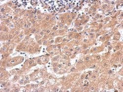Invitrogen alanyl-tRNA Synthetase Polyclonal Antibody 100 &mu;L; Unconjugated:Antibodies,