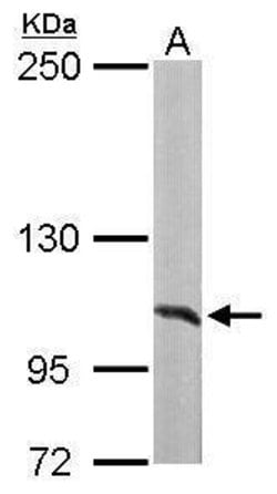 Invitrogen alanyl-tRNA Synthetase Polyclonal Antibody 100 &mu;L; Unconjugated:Antibodies,