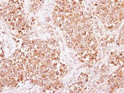 Invitrogen beta-2 Adaptin Polyclonal Antibody 100 &mu;L; Unconjugated:Antibodies,