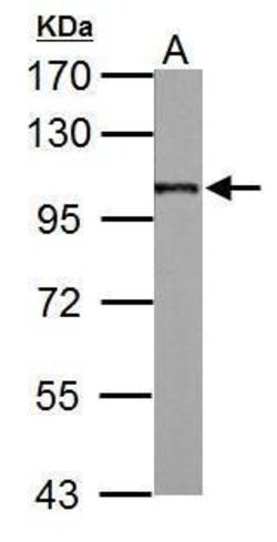 Invitrogen beta-2 Adaptin Polyclonal Antibody 100 &mu;L; Unconjugated:Antibodies,