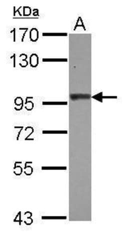 Invitrogen beta-2 Adaptin Polyclonal Antibody 100 &mu;L; Unconjugated:Antibodies,