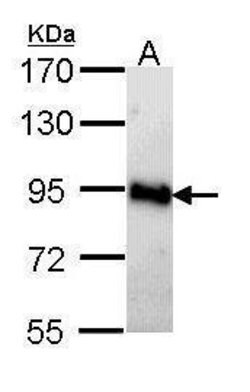 Invitrogen AMPD2 Polyclonal Antibody 100 &mu;L | Buy Online | Invitrogen&trade; | Fisher Scientific