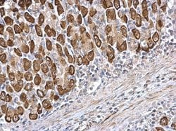 Invitrogen CDS1 Polyclonal Antibody 100 &mu;L; Unconjugated:Antibodies,