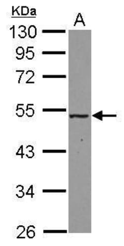 Invitrogen MAT2A Polyclonal Antibody 100 μL; Unconjugated:Antibodies,