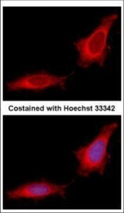 Invitrogen GANC Polyclonal Antibody 100 μL; Unconjugated:Antibodies,
