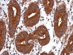 Invitrogen GANC Polyclonal Antibody 100 μL; Unconjugated:Antibodies,
