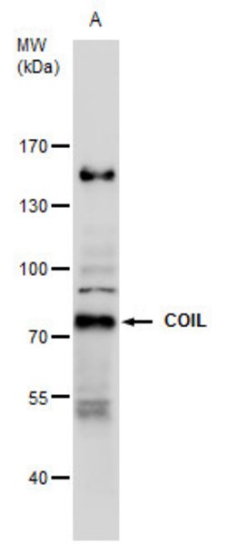 Invitrogen Coilin Polyclonal Antibody 100 &mu;L | Buy Online | Invitrogen&trade; | Fisher Scientific