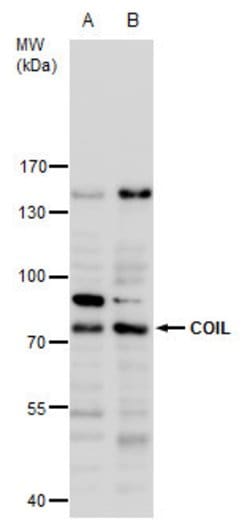 Invitrogen Coilin Polyclonal Antibody 100 &mu;L | Buy Online | Invitrogen&trade; | Fisher Scientific