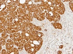 ERO1L Polyclonal Antibody, Invitrogen 100 &mu;L; Unconjugated:Antibodies,