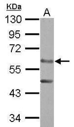 ERO1L Polyclonal Antibody, Invitrogen™