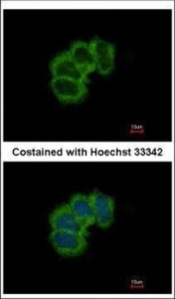 Invitrogen eIF4B Polyclonal Antibody 100 &mu;L; Unconjugated:Anticuerpos