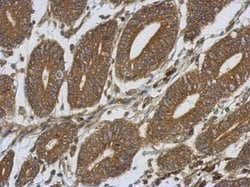 SIRP alpha Polyclonal Antibody, Invitrogen 100 &mu;L; Unconjugated:Antibodies,