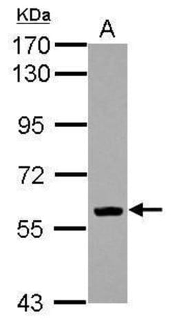 Invitrogen&trade;&nbsp;EBF1 Polyclonal Antibody