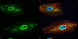 Invitrogen&trade;&nbsp;GSTP1 Polyclonal Antibody