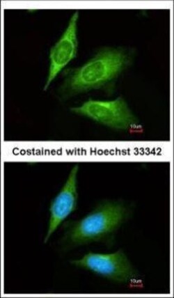 Invitrogen TMED4 Polyclonal Antibody 100 &mu;L | Buy Online | Invitrogen&trade; | Fisher Scientific