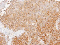 Invitrogen TMED4 Polyclonal Antibody 100 &mu;L | Buy Online | Invitrogen&trade; | Fisher Scientific