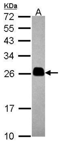 Invitrogen TMED4 Polyclonal Antibody 100 &mu;L | Buy Online | Invitrogen&trade; | Fisher Scientific