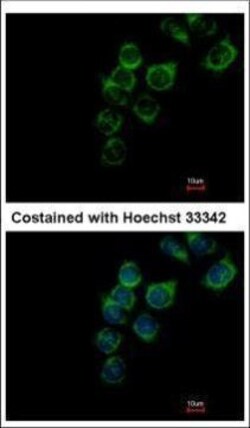 Invitrogen Transferrin Polyclonal Antibody 100 &mu;L | Buy Online | Invitrogen&trade; | Fisher Scientific