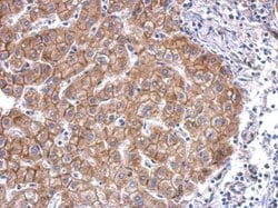 Invitrogen N-cadherin Polyclonal Antibody 100 &mu;L; Unconjugated:Antibodies,