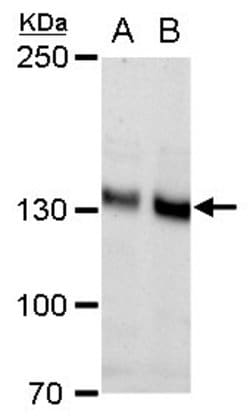 Invitrogen N-cadherin Polyclonal Antibody 100 &mu;L; Unconjugated:Antibodies,