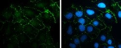 Invitrogen N-cadherin Polyclonal Antibody 100 &mu;L; Unconjugated:Antibodies,