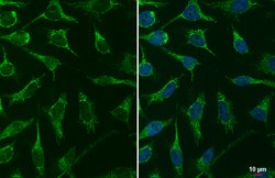 Invitrogen TFAM Polyclonal Antibody 100 &mu;L; Unconjugated:Antibodies,
